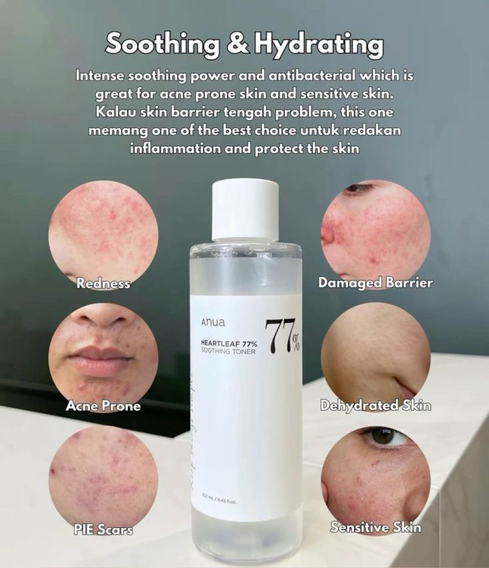 تونر انو مناسب انواع پوست مخصوصا پوست حساس روشن کننده ضدلک آبرسانی به پوست